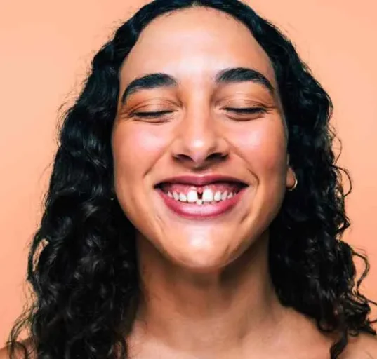 Treatment for diastema